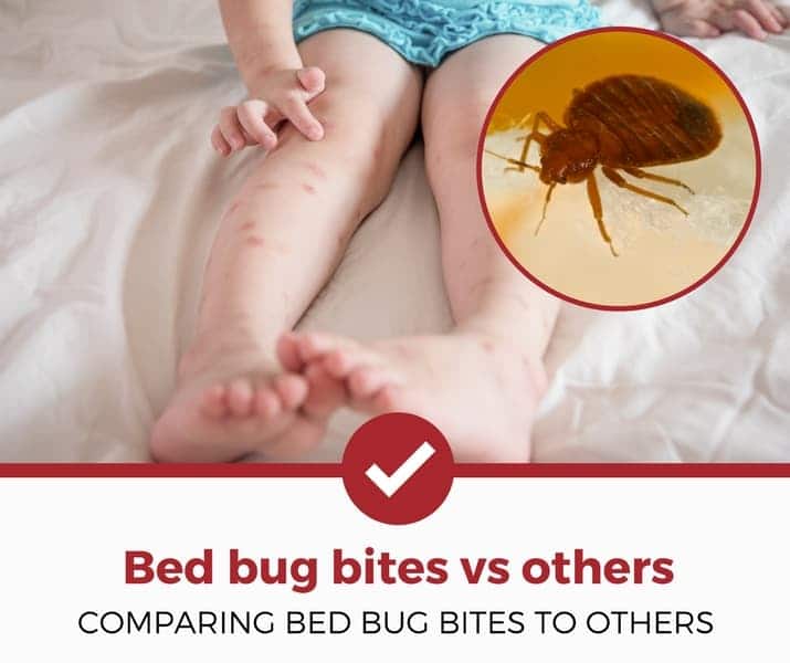 bed bug bites vs other bug bites