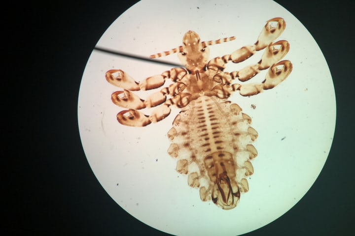 a louse under a microscope