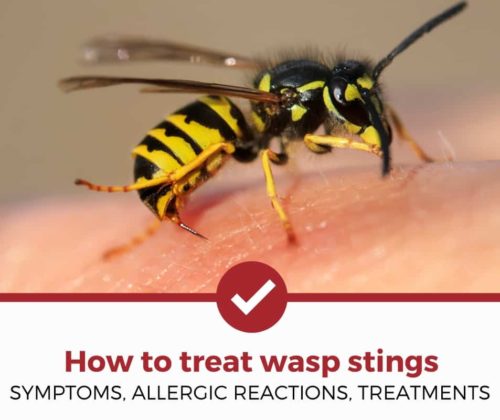 如何治疗黄蜂蜇伤